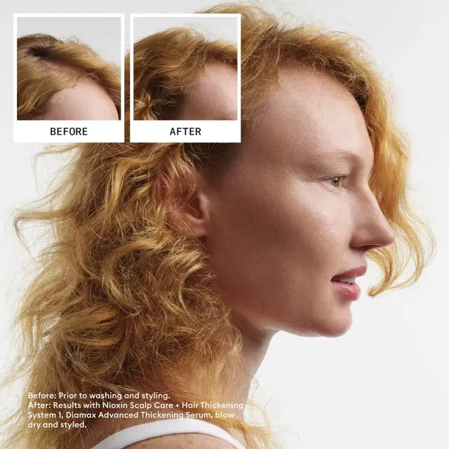 Nioxin Hair System Kit 1