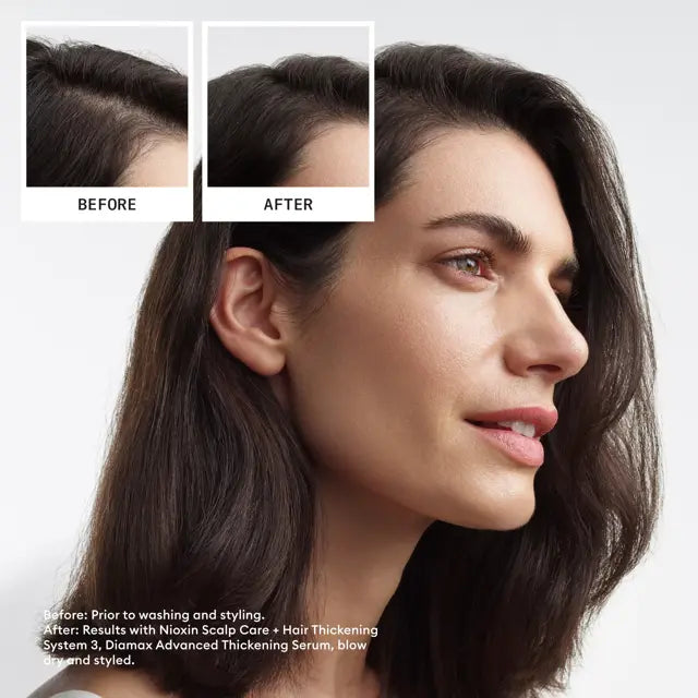 Nioxin_Restage_NA_Ecomm_SystemKit3TrialSize_SI4_2024.webp