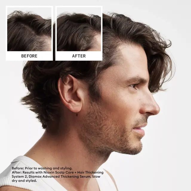Nioxin_System_KIT_2_Shampoo_300ml_Conditioner_300ml_Treatment_100ml_SI_4.webp